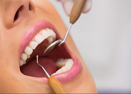 Crowns, Bridges & Veneers - Triple A Dental Clinic